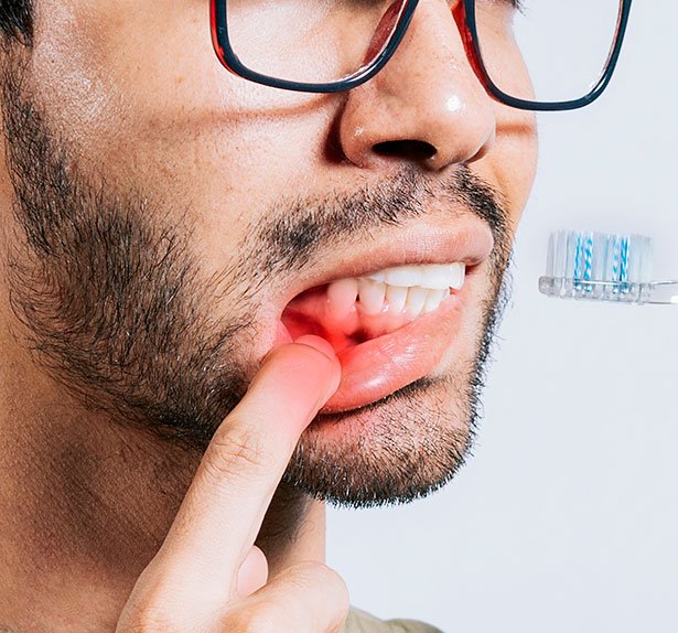 Tratamiento de Periodoncia en Hortaleza