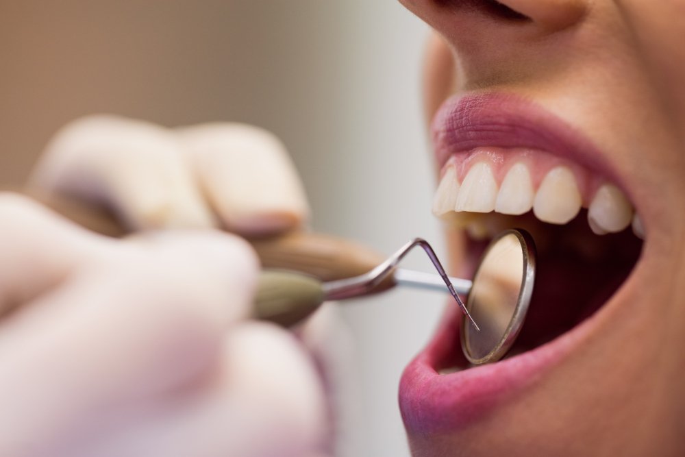 qué es la gingivitis