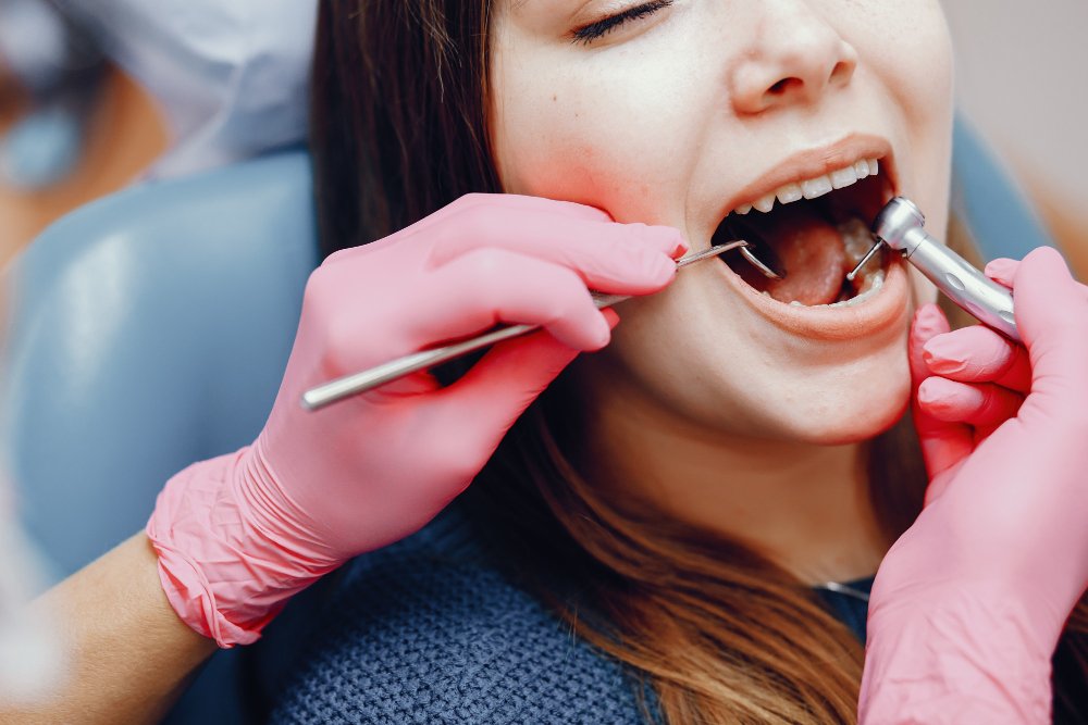 tratamientos para la gingivitis