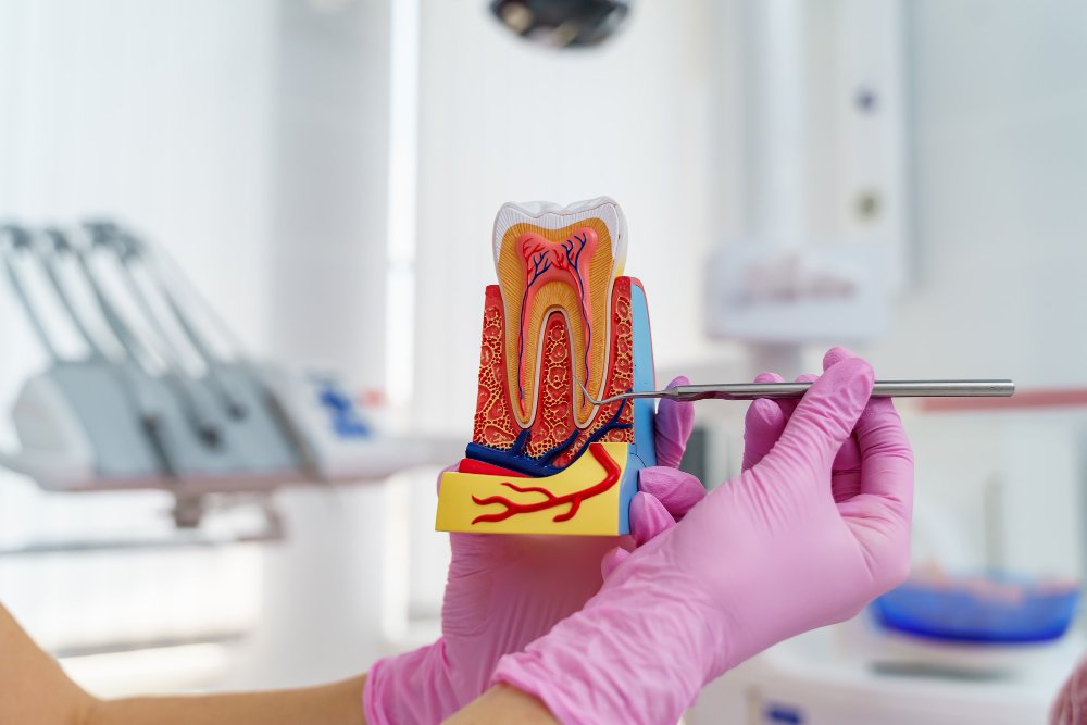 tratamiento de endodoncia