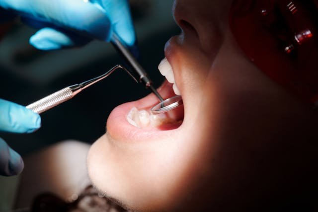 dolor en los dientes por sensibilidad
