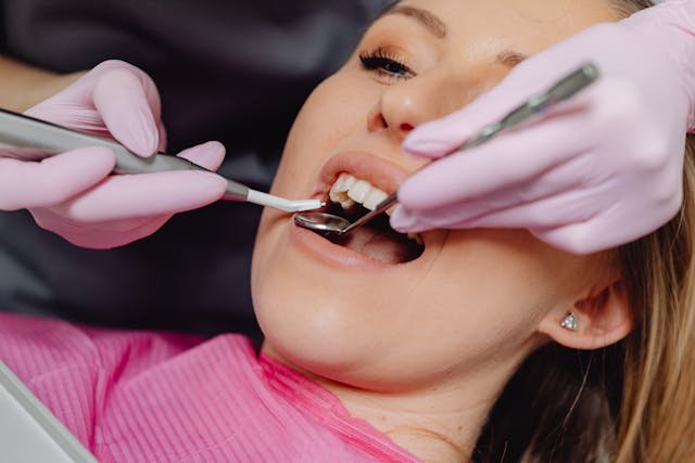 como tratar las manchas en los dientes