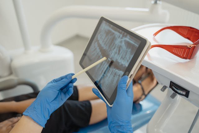 tratamientos bucales postoperatorios