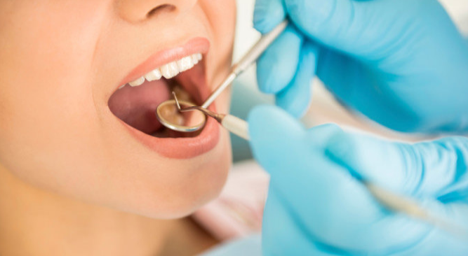 Cada cuánto tiempo debo ir al dentista