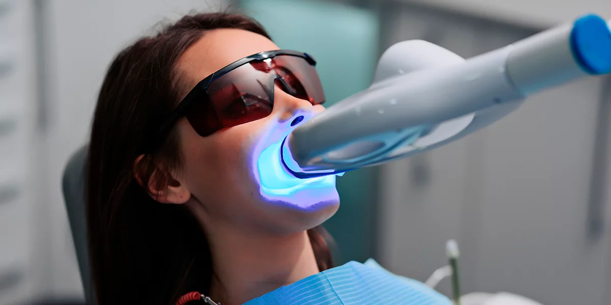 Blanqueamiento dental es seguro cuándo es recomendable