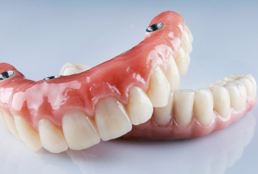 Tratamiento Dental con Prótesis: Soluciones a Medida