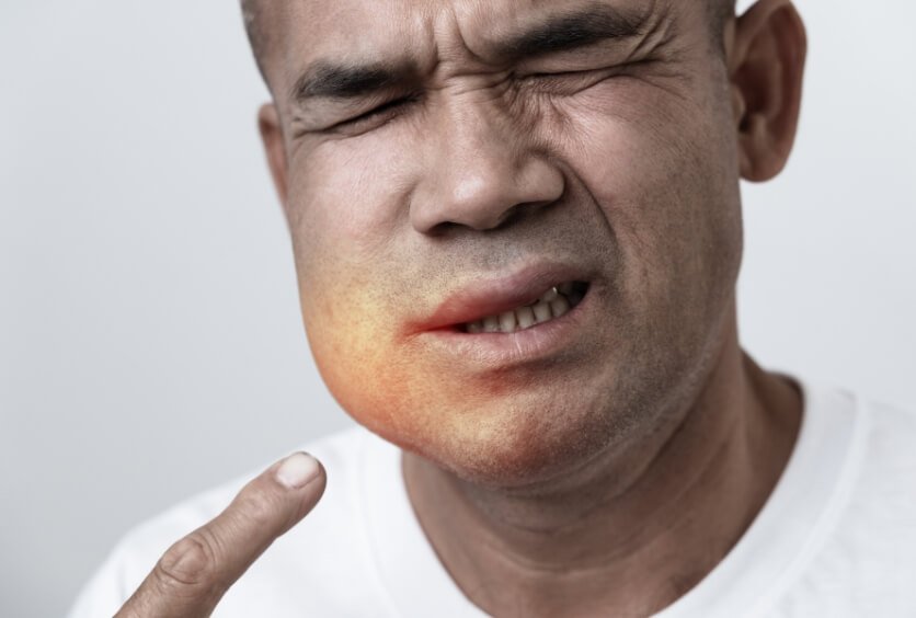 Urgencias Dentales: Qué Hacer Ante Dolor, Fracturas o Traumatismos