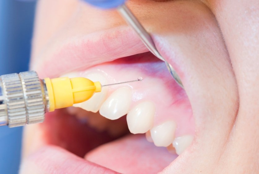 Urgencias Dentales: Qué Hacer Ante Dolor, Fracturas o Traumatismos