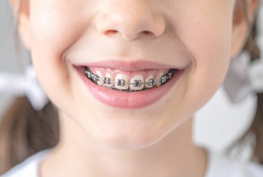 Ortodoncia en Niños: Guía Completa, Profesional y Práctica