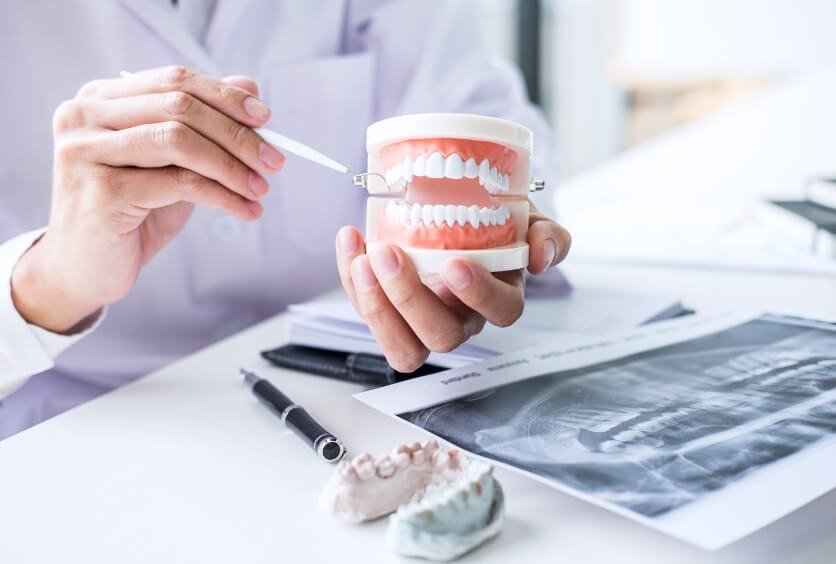 Prótesis dentales: tipos, diferencias, indicaciones y cómo elegir la solución adecuada