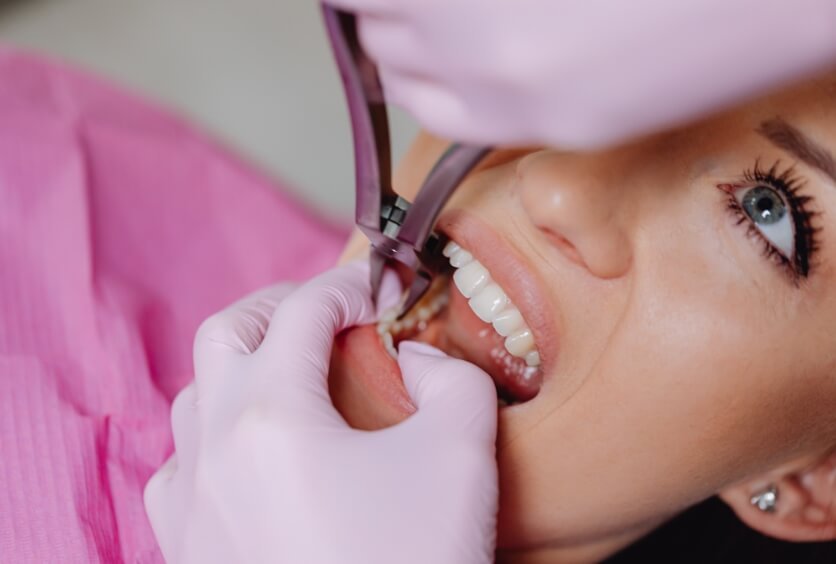 Clínica Dental Especializada en Implantes Dentales y Periodoncia