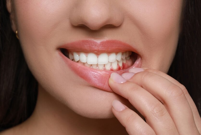 Periodoncia: Qué es, Cómo se Trata y Por qué es Clave para Conservar tus Dientes
