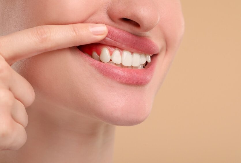 Periodoncia: Qué es, Cómo se Trata y Por qué es Clave para Conservar tus Dientes