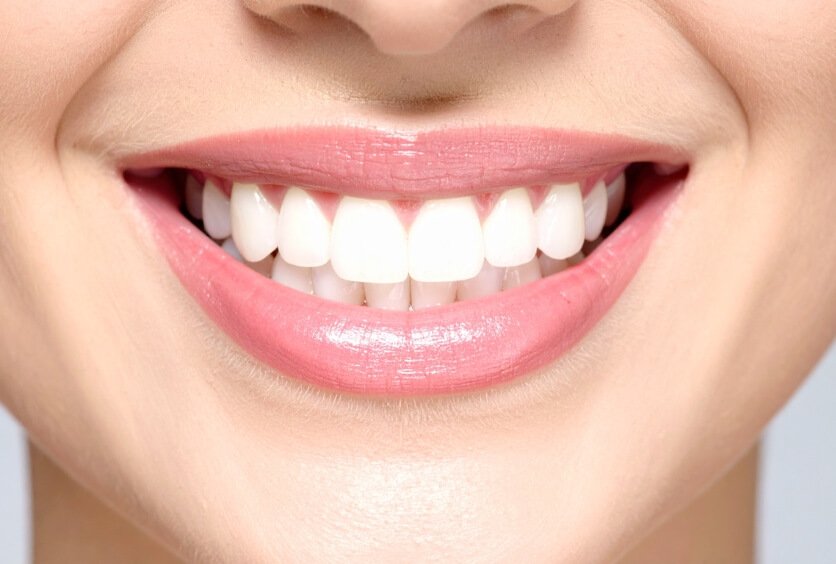 Planificación Estética Personalizada para Lograr una Sonrisa Armónica, Natural y Funcional