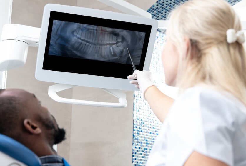 TAC dental: Diagnóstico en 3D para Implantes, Cirugía y Tratamientos más Precisos