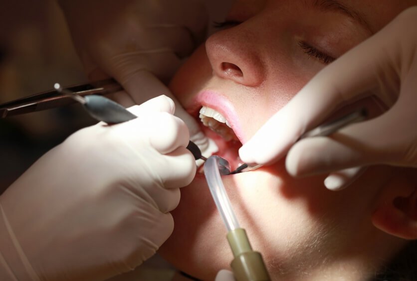 Endodoncia: Señales Que Indican Que Necesitas un Tratamiento de Conductos