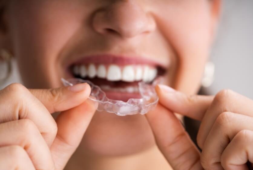 Cómo Saber Si Aprietas Los Dientes Mientras Duermes
