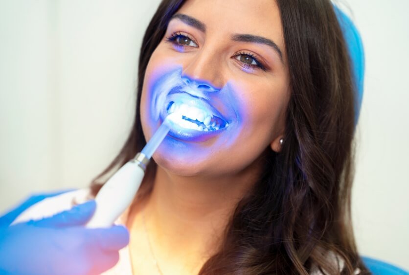 Blanqueamiento Dental En Verano: Cuidados, Recomendaciones Y Lo Que Debes Saber